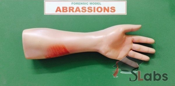Abrassions