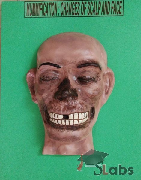Mummification: – Changes Of Scalp And Face